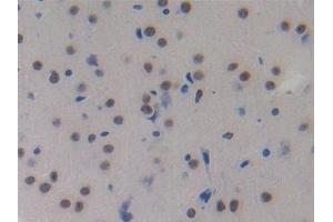 Detection of MCP2 in Mouse Brain Tissue using Polyclonal Antibody to Monocyte Chemotactic Protein 2 (MCP2)