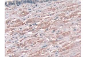 Detection of AASS in Human Prostate Tissue using Polyclonal Antibody to Aminoadipate Semialdehyde Synthase (AASS)