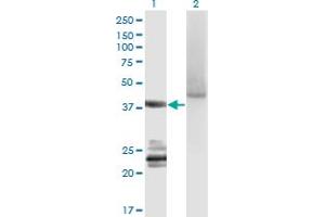 Western Blot analysis of GNA14 expression in transfected 293T cell line by GNA14 monoclonal antibody (M06A), clone 2H8.