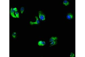 Immunofluorescence staining of MCF-7 cells with ABIN7156768 at 1:66, counter-stained with DAPI.