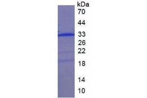 SDS-PAGE analysis of Human Collectin Liver 1 Protein. (COLEC10 Protéine)