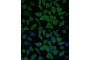 Immunofluorescence analysis of L929 cells using IDH1 Polyclonal Antibody (ABIN6131797, ABIN6142143, ABIN6142144 and ABIN6217174) at dilution of 1:100 (40x lens).