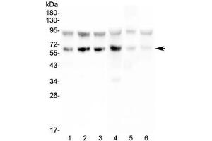 Western blot testing of PD1 antibody and Lane 1:  Jurkat