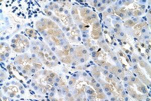 Image no. 1 for anti-Tumor Susceptibility Gene 101 (TSG101) (AA 121-170) antibody (ABIN202410)