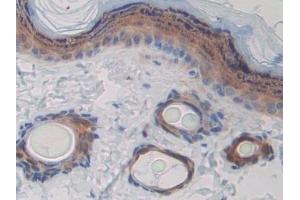 Detection of CD244 in Rat Skin Tissue using Polyclonal Antibody to Cluster of Differentiation 244 (CD244)