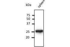 Anti-Rab14 Ab at 1/500 dilution, lysates at 50 µg per Iane, rabbit polyclonal to goat lµg (HR? (RAB5 anticorps  (C-Term))