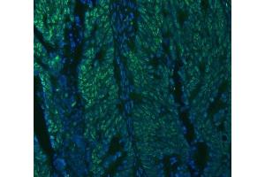 IF analysis of U1A/SNRPA using anti-U1A/SNRPA antibody (ABIN7600891). (SNRPA1 anticorps  (AA 25-218))