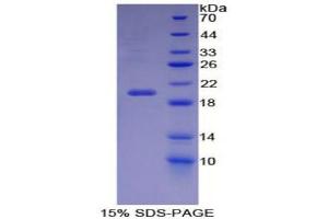 SDS-PAGE (SDS) image for Carbonic Anhydrase VI (CA6) (AA 27-181) protein (His tag) (ABIN1170004)