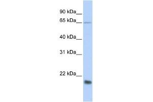WB Suggested Anti-MUC1 Antibody Titration:  0. (MUC1 anticorps  (Middle Region))