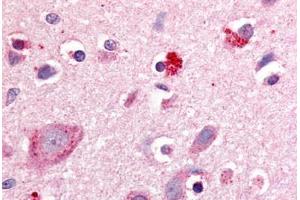 Anti-ROR Beta antibody  ABIN1049297 IHC staining of human brain, cortex. (RORB anticorps  (Hinge Region))