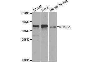 Western blot analysis of extracts of various cell lines, using NFKBIA antibody. (NFKBIA anticorps)