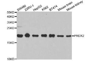 Western blot analysis of extracts of various cell lines, using PRDX2 antibody. (Peroxiredoxin 2 anticorps  (AA 1-142))