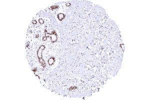 Intense nuclear TRPS1 staining of luminal but not basal breast epithelial cells Dilution 1:20