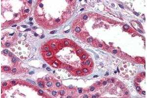 Human Kidney: Formalin-Fixed, Paraffin-Embedded (FFPE)