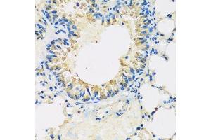 Immunohistochemistry of paraffin-embedded mouse lung using ABCF2 antibody.