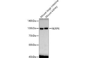 Western blot analysis of extracts of various cell lines, using NLRP6 antibody  at 1:1570 dilution. (NLRP6 anticorps  (AA 100-200))