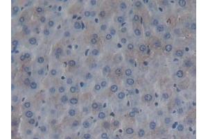 Detection of FMOD in Rat Liver Tissue using Polyclonal Antibody to Fibromodulin (FMOD) (Fibromodulin anticorps  (AA 19-376))