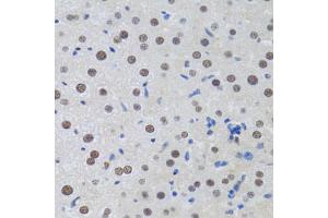 Immunohistochemistry of paraffin-embedded rat liver using MT antibody (ABIN6128251, ABIN6144117, ABIN6144118 and ABIN6222360) at dilution of 1:100 (40x lens).