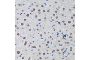 Immunohistochemistry of paraffin-embedded rat liver using MT antibody (ABIN6128251, ABIN6144117, ABIN6144118 and ABIN6222360) at dilution of 1:100 (40x lens). (MTA3 anticorps  (AA 40-330))