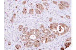 IHC-P Image Immunohistochemical analysis of paraffin-embedded NCIN87 xenograft, using DDT, antibody at 1:100 dilution. (DDT anticorps)