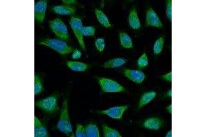 Immunofluorescent analysis of HSP70 staining in Hela cells. (HSP70 anticorps)