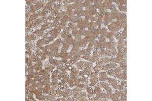 Immunohistochemical staining of human liver with MDGA1 polyclonal antibody  shows strong cytoplasmic positivity in hepatocytes at 1:20-1:50 dilution. (MDGA1 anticorps)