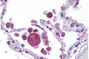 Human Lung: Formalin-Fixed, Paraffin-Embedded (FFPE)