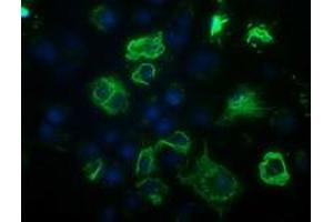 Anti-BCL10 mouse monoclonal antibody (ABIN2454087) immunofluorescent staining of COS7 cells transiently transfected by pCMV6-ENTRY BCL10 (RC208752). (BCL10 anticorps)