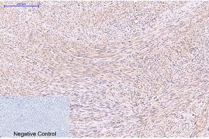 Immunohistochemical analysis of paraffin-embedded human uterus tissue. (EFHD1 anticorps)