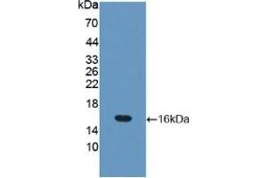 WB of Protein Standard: different control antibodies against Highly purified E. (Occludin Kit ELISA)