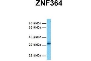 Host:  Rabbit  Target Name:  ZNF364  Sample Tissue:  Human 293T  Antibody Dilution:  1. (RNF115 anticorps  (C-Term))