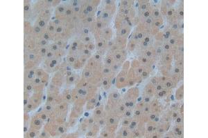 #VALUE! (DKC1 anticorps)