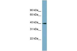 WB Suggested Anti-SLC25A22 Antibody Titration:  0. (SLC25A22 anticorps  (N-Term))