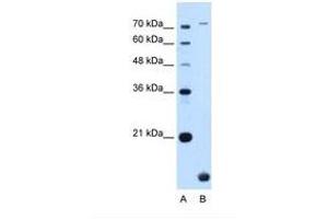 Image no. 1 for anti-Transmembrane Protein 91 (TMEM91) (N-Term) antibody (ABIN6739191) (TMEM91 anticorps  (N-Term))