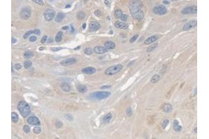 Detection of SMN2 in Human Esophagus Tissue using Polyclonal Antibody to Survival Of Motor Neuron 2, Centromeric (SMN2)