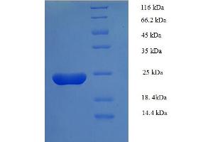 SDS-PAGE (SDS) image for Serum Amyloid A (SAA) (AA 1-90), (full length) protein (His tag,B2M) (ABIN5710306)