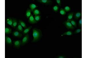Immunofluorescence staining of A549 cells with ABIN7161158 at 1:166, counter-stained with DAPI.