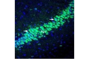 Expression of KChIP2 in mouse hippocampus - Immunohistochemical staining of perfusion-fixed frozen mouse brain sections using Anti-KChIP2 Antibody (ABIN7043296, ABIN7045040 and ABIN7045041), (1:400), followed by goat-anti-rabbit-Alexa-488 (green).