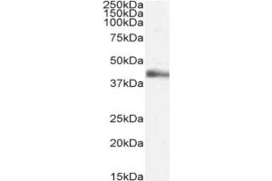 Western Blot using anti-Lymphotoxin alpha antibody 3F12. (Recombinant LTA anticorps)