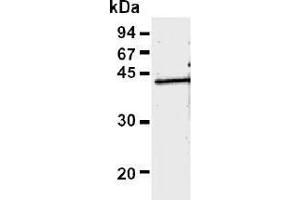 Western Blotting (WB) image for anti-Recombinase A / RecA (AA 260-347) antibody (ABIN1449298) (Recombinase A / RecA (AA 260-347) anticorps)