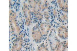 Used in DAB staining on fromalin fixed paraffin- embedded stomach tissue