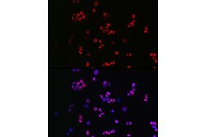 Immunofluorescence analysis of F9 cells using [KO Validated] SOX2 Rabbit pAb (ABIN3021002, ABIN3021003, ABIN3021004 and ABIN6213889) at dilution of 1:50 (40x lens). (SOX2 anticorps  (AA 1-140))