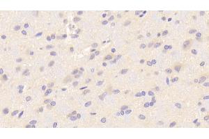 Detection of NFE2L2 in Rat Cerebrum Tissue using Polyclonal Antibody to Nuclear Factor, Erythroid Derived 2 Like Protein 2 (NFE2L2)