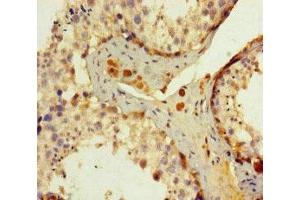 Immunohistochemistry of paraffin-embedded human testis tissue using ABIN7150168 at dilution of 1:100 (ERCC1 anticorps  (AA 1-323))