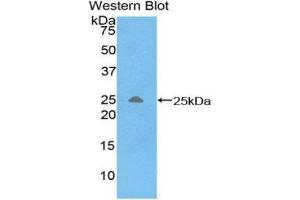 Western Blotting (WB) image for anti-Triggering Receptor Expressed On Myeloid Cells 1 (TREM1) (AA 21-205) antibody (ABIN1860864) (TREM1 anticorps  (AA 21-205))