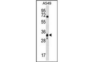 Western blot analysis of MCART6 Antibody (C-term) Cat. (MCART6 anticorps  (C-Term))