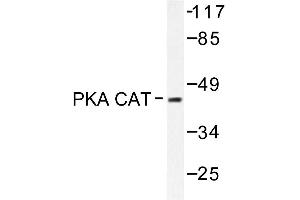 Image no. 1 for anti-V-Akt Murine Thymoma Viral Oncogene Homolog 1 (AKT1) antibody (ABIN272061) (AKT1 anticorps)