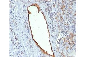 IHC staining of tonsil tissue with PECAM-1 antibody (C31. (CD31 anticorps)