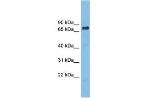 WB Suggested Anti-LBR Antibody Titration: 0. (Lamin B Receptor anticorps  (Middle Region))