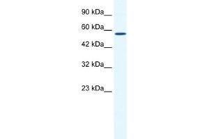WB Suggested Anti-BTBD15 Antibody Titration:  0. (ZBTB44 anticorps  (C-Term))